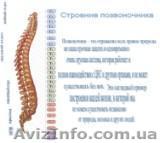 Боли в спине,  курс обучения. - <ro>Изображение</ro><ru>Изображение</ru> #1, <ru>Объявление</ru> #435081