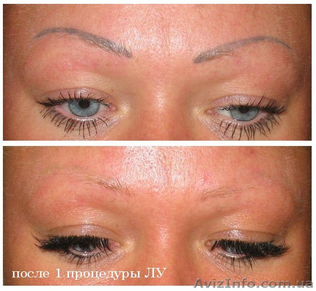 Удалить татуаж (перманентный макияж) лазером – 150 грн - Днепропетровск - <ro>Изображение</ro><ru>Изображение</ru> #1, <ru>Объявление</ru> #1174162