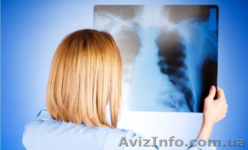 Утилизация рентгенпленки, фиксажа, кинопленки! - <ro>Изображение</ro><ru>Изображение</ru> #1, <ru>Объявление</ru> #1186522