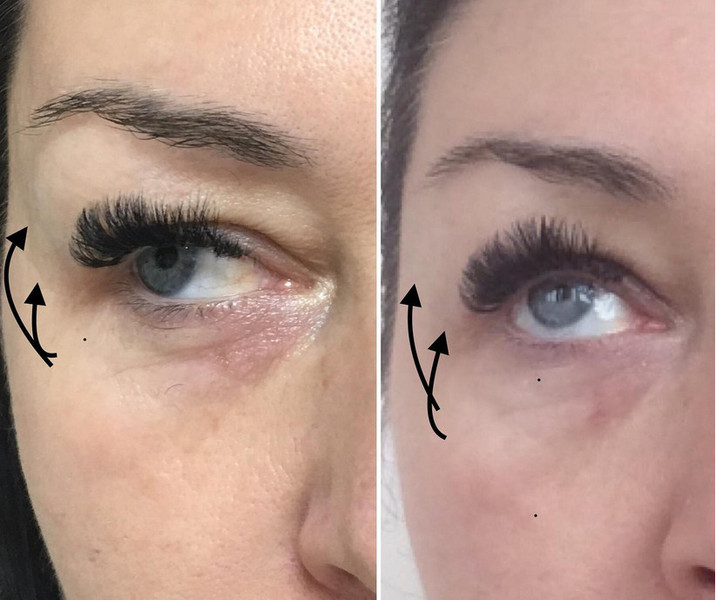 Услуги косметолога: чистка лица, пилинги - <ro>Изображение</ro><ru>Изображение</ru> #1, <ru>Объявление</ru> #1664179