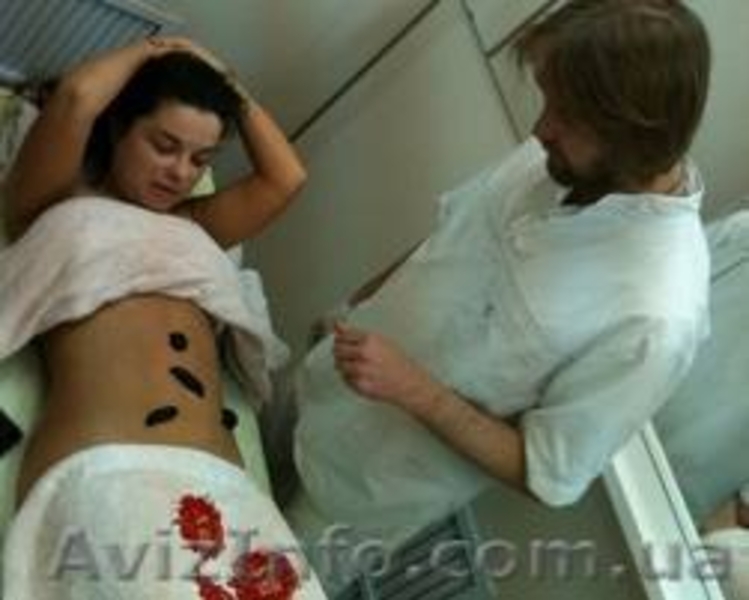 Лечение пиявками женских заболеваний c выездом к пациенту - <ro>Изображение</ro><ru>Изображение</ru> #3, <ru>Объявление</ru> #244106