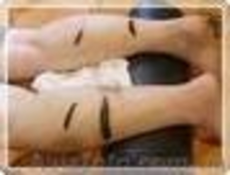 Лечение пиявками женских заболеваний c выездом к пациенту - <ro>Изображение</ro><ru>Изображение</ru> #7, <ru>Объявление</ru> #244106