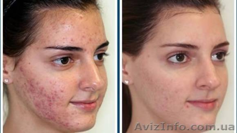 Салон красоты "Надія" - <ro>Изображение</ro><ru>Изображение</ru> #7, <ru>Объявление</ru> #1288564