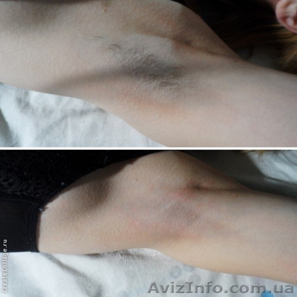 Наращивание ресниц,шугаринг(сахарная эпиляция) - <ro>Изображение</ro><ru>Изображение</ru> #3, <ru>Объявление</ru> #1285775