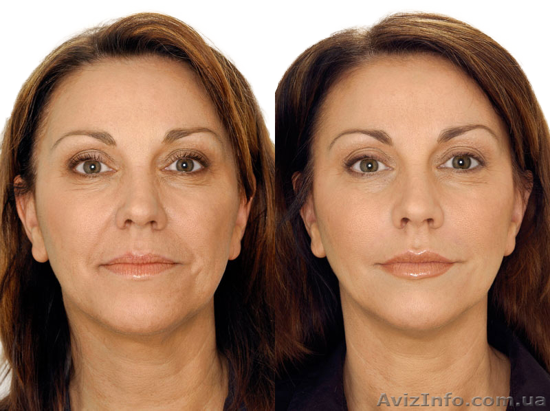 наращивание ресниц Днепропетровск, чистка лица, массаж лица, эпиляция и др - <ro>Изображение</ro><ru>Изображение</ru> #3, <ru>Объявление</ru> #1315631